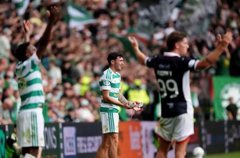 Quand la Mercurial d&rsquo;un joueur du Celtic se fait fracasser en plein match