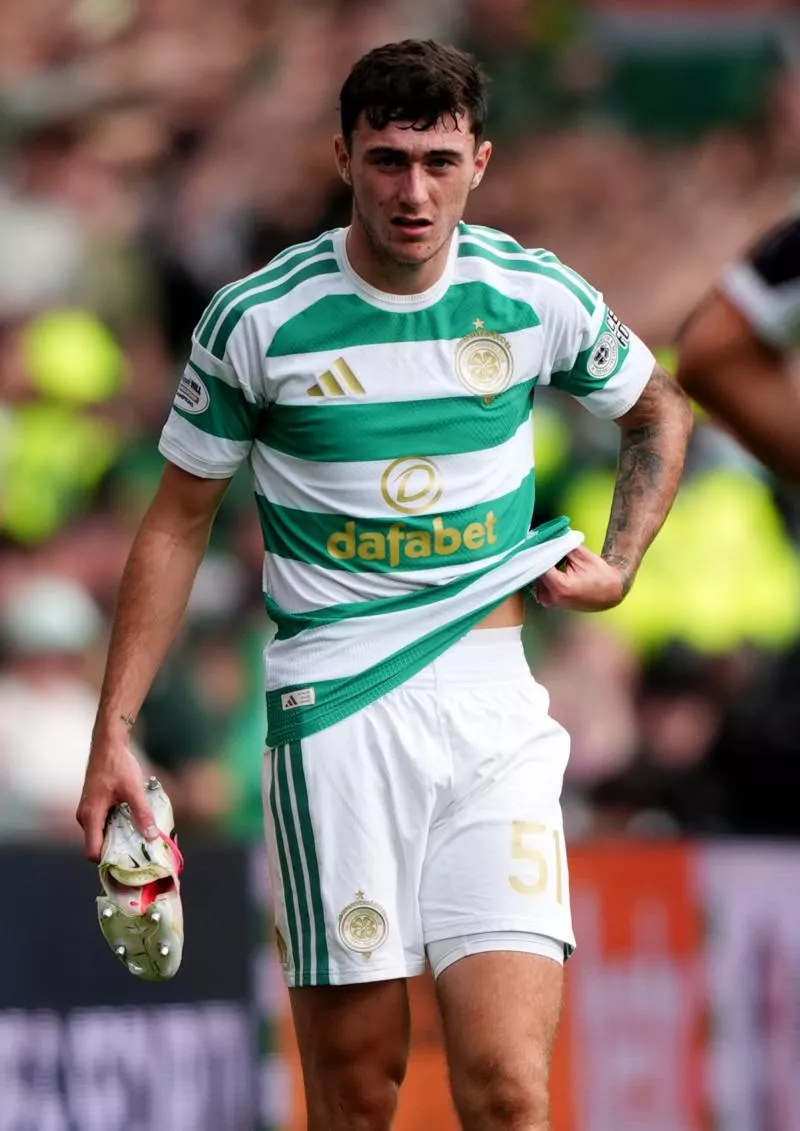 Celtic's Colby Donovan with a problem with his left boot after it split during the William Hill Premiership match at Celtic Park, Glasgow. Picture date: Saturday August 29, 2026. - Photo by Icon Sport